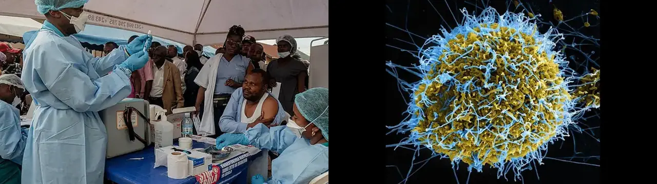 Africa CDC kallar eftir alþjóðlegri aðstoð vegna ebólu